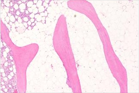 microtomy of bone tissue